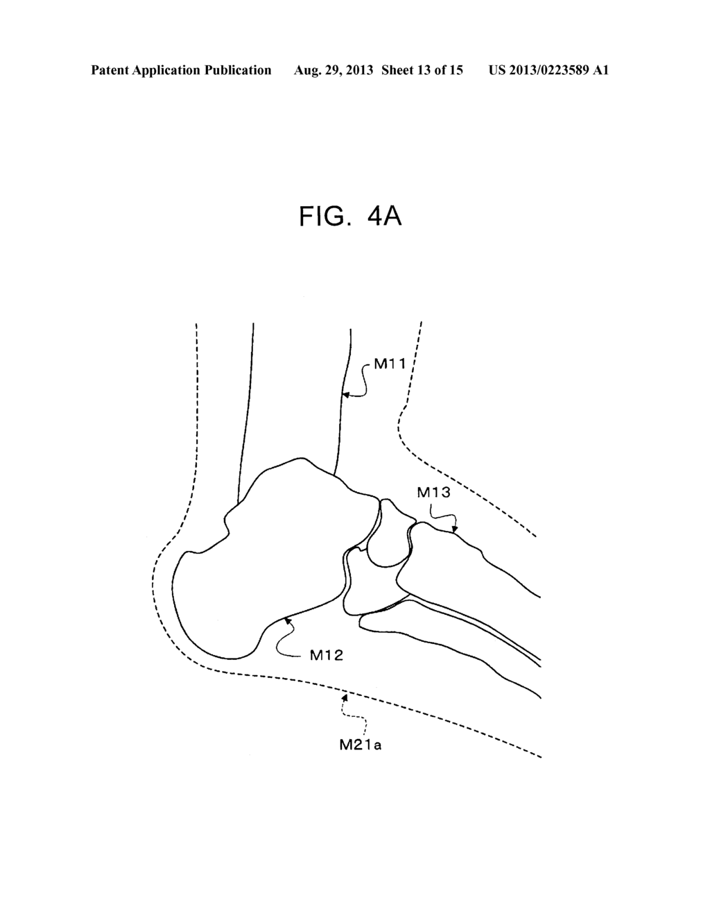 MEDICAL IMAGE PROCESSING APPARATUS - diagram, schematic, and image 14