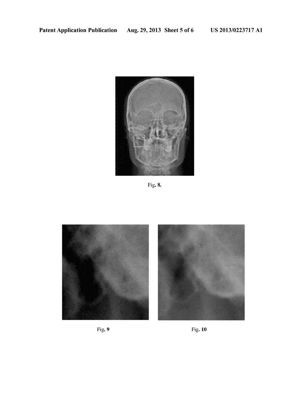 Method for Correction of Digital Images - diagram, schematic, and image 06