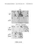 USE OF ADENOSINE RECEPTOR SIGNALING TO MODULATE PERMEABILITY OF     BLOOD-BRAIN BARRIER diagram and image