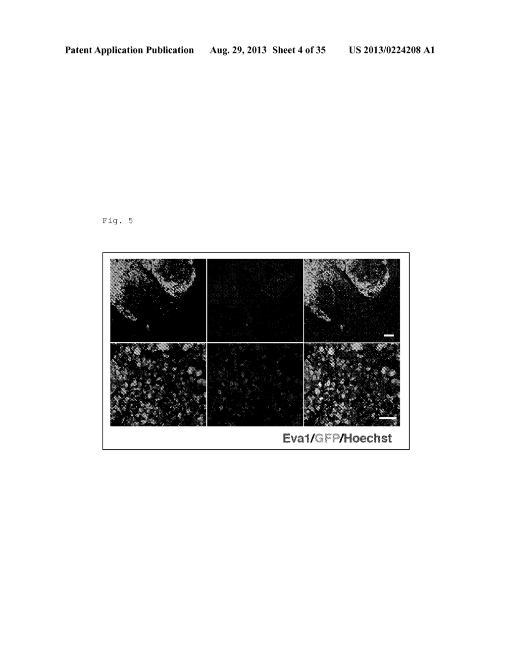 GLIOMA TREATMENT METHOD, GLIOMA TESTING METHOD, METHOD FOR DELIVERING     DESIRED SUBSTANCE TO GLIOMA, AND DRUGS USED IN THESE METHODS - diagram, schematic, and image 05