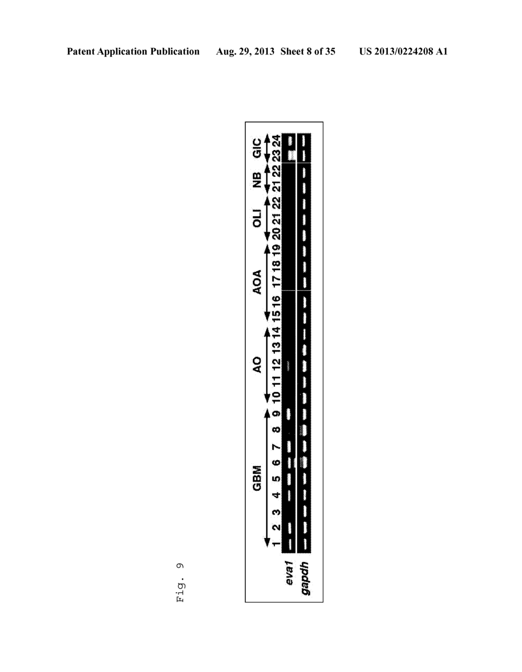 GLIOMA TREATMENT METHOD, GLIOMA TESTING METHOD, METHOD FOR DELIVERING     DESIRED SUBSTANCE TO GLIOMA, AND DRUGS USED IN THESE METHODS - diagram, schematic, and image 09