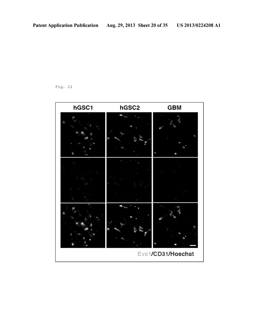 GLIOMA TREATMENT METHOD, GLIOMA TESTING METHOD, METHOD FOR DELIVERING     DESIRED SUBSTANCE TO GLIOMA, AND DRUGS USED IN THESE METHODS - diagram, schematic, and image 21