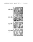 IMMUNOTHERAPEUTIC METHOD FOR TREATING PROSTATE CANCER diagram and image