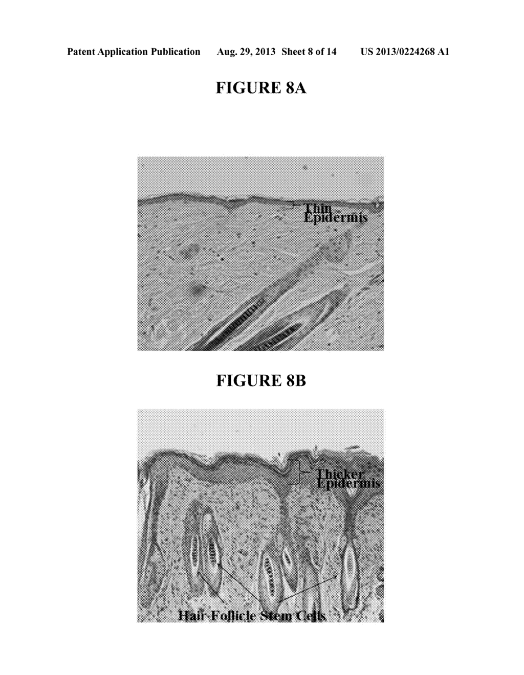 TOPICAL DELIVERY OF HORMONAL AND NON HORMONAL NANO FORMULATIONS, METHODS     OF MAKING AND USING THE SAME - diagram, schematic, and image 09