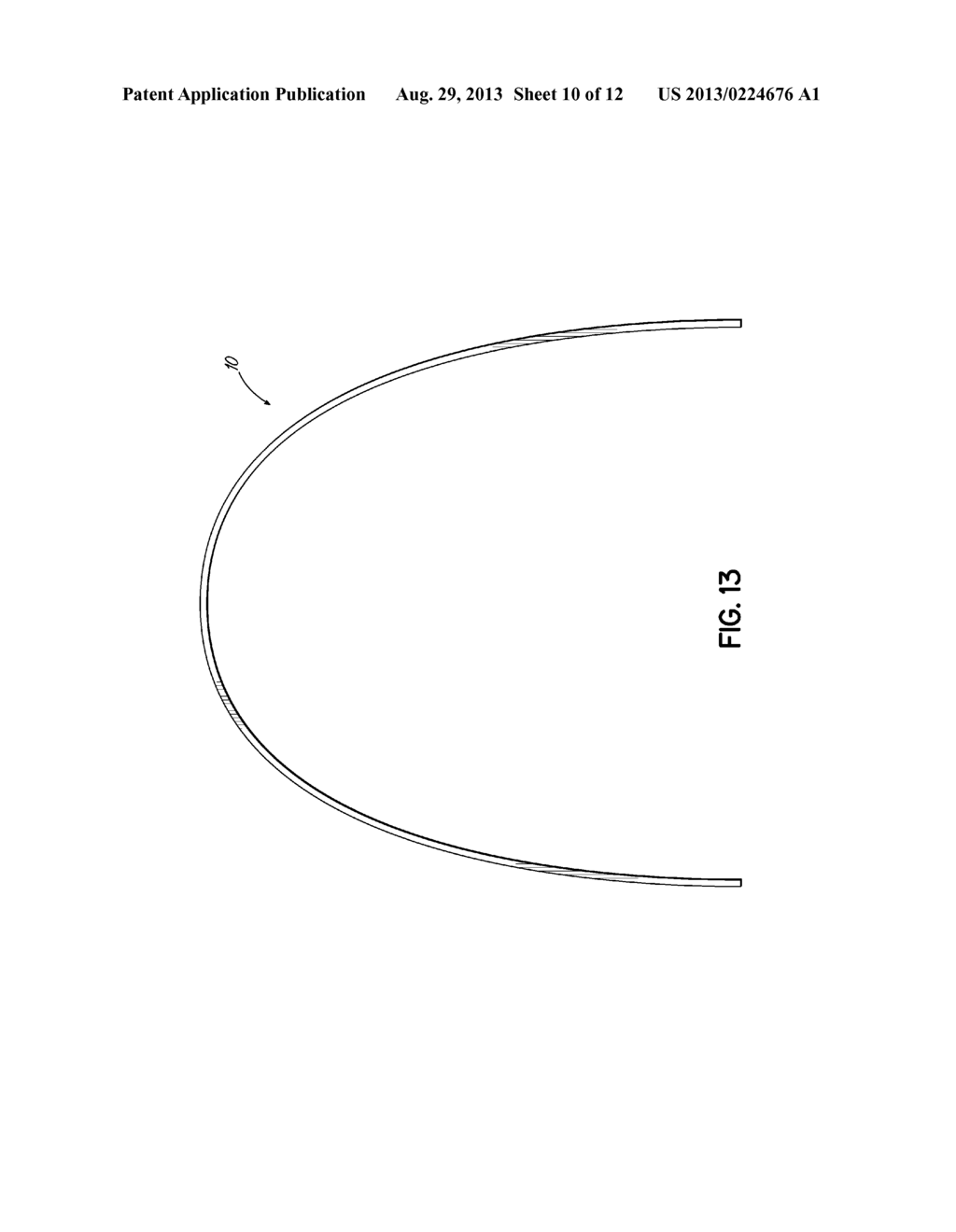 METALLIC GLASS ORTHODONTIC APPLIANCES AND METHODS FOR THEIR MANUFACTURE - diagram, schematic, and image 11