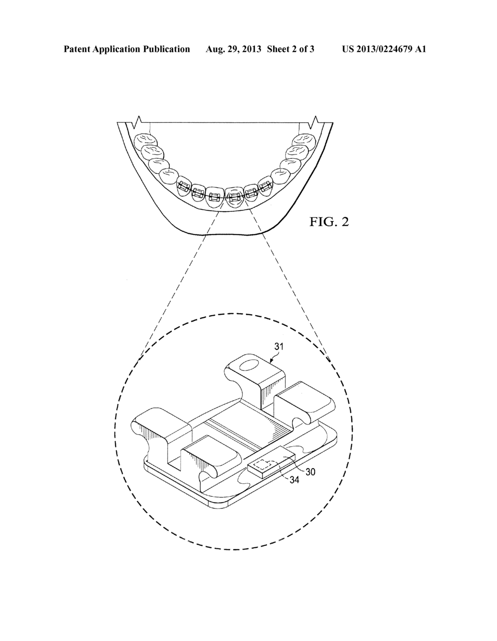 ELECTROCHEMICAL DISPENSING APPARATUS AND METHOD - diagram, schematic, and image 03