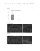 Adeno-Associated Virus Virion for Gene Transfer to Nervous System Cells diagram and image