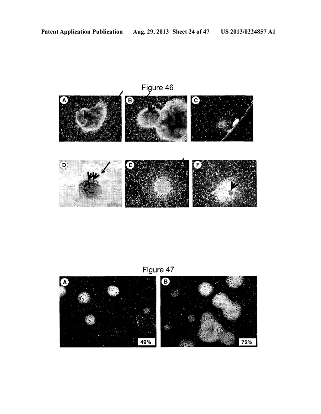 METHOD OF DIFFERENTIATING STEM CELLS - diagram, schematic, and image 25