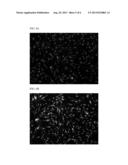 COATINGS AND CULTURE MEDIA FOR PROMOTING NEUROGENESIS IN ADIPOSE TISSUE     DERIVED STEM CELLS diagram and image