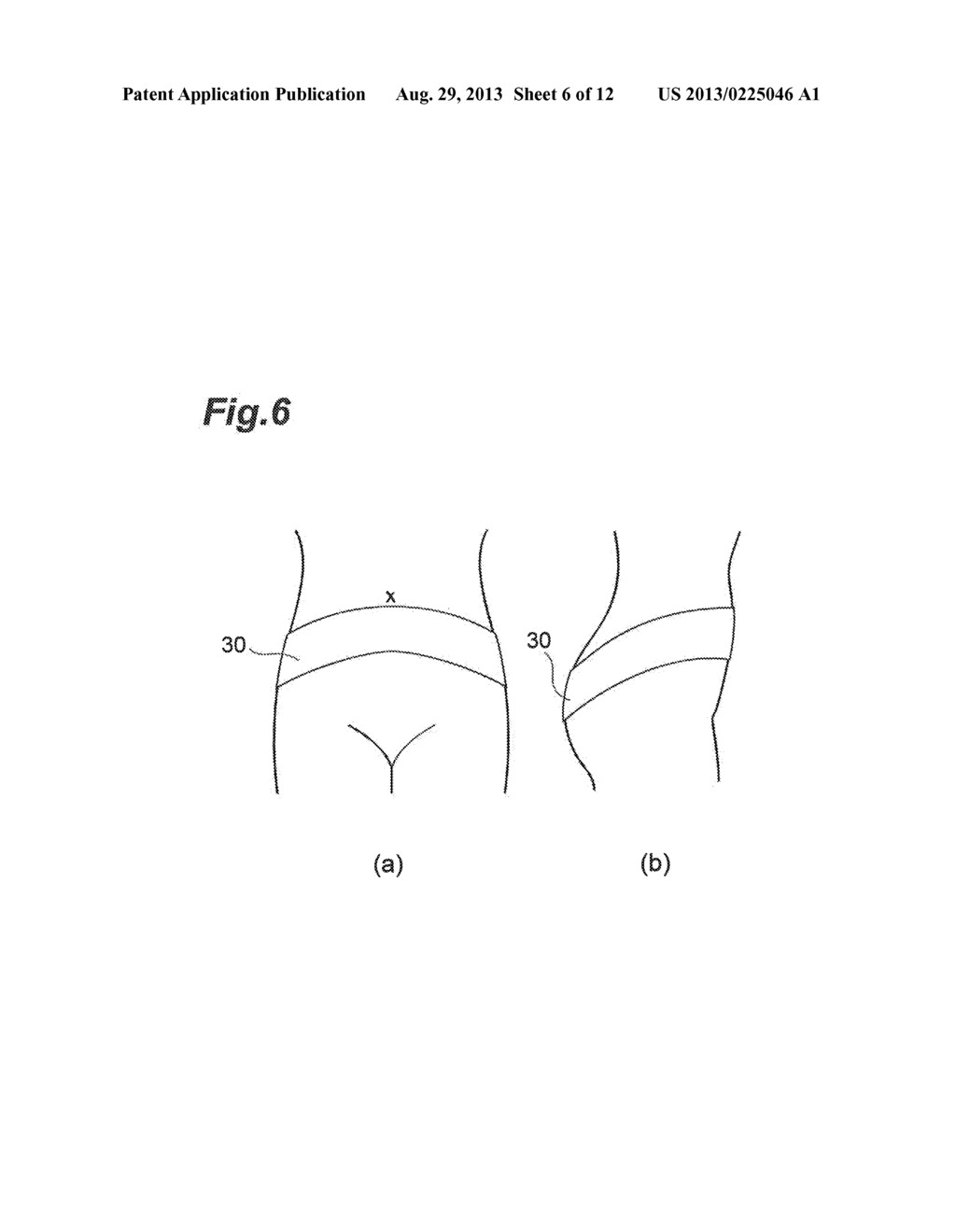 SKIRT-TYPE CONTROLLING UNDERGARMENT - diagram, schematic, and image 07