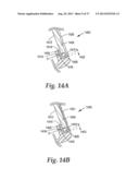 GOLF CLUB HEADS WITH IMPROVED SOUND CHARACTERISTICS diagram and image