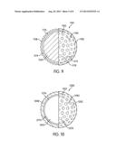 Ball Incorporating Element to Remove Cover diagram and image