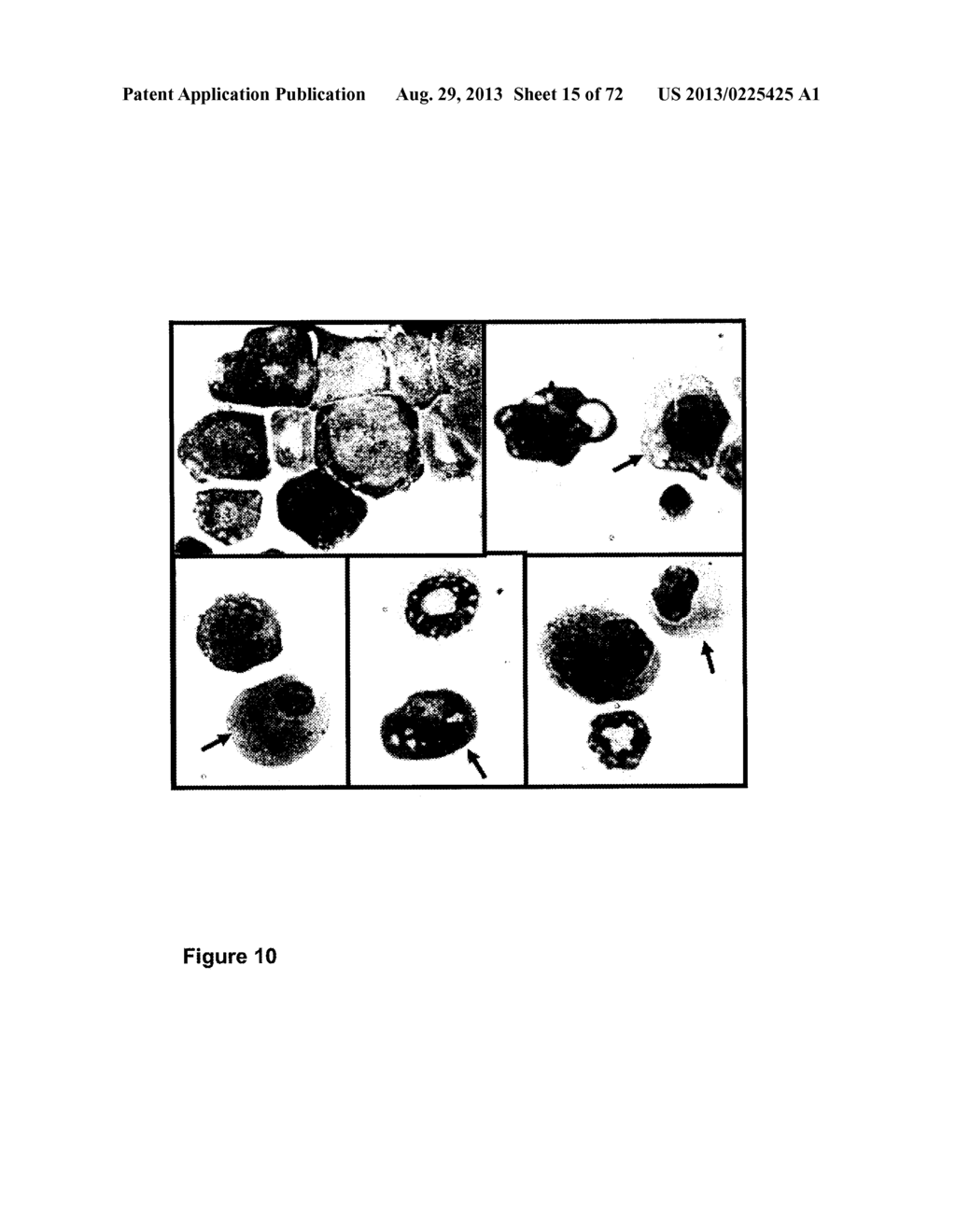 Modulation of NR2F6 and methods and uses thereof - diagram, schematic, and image 16