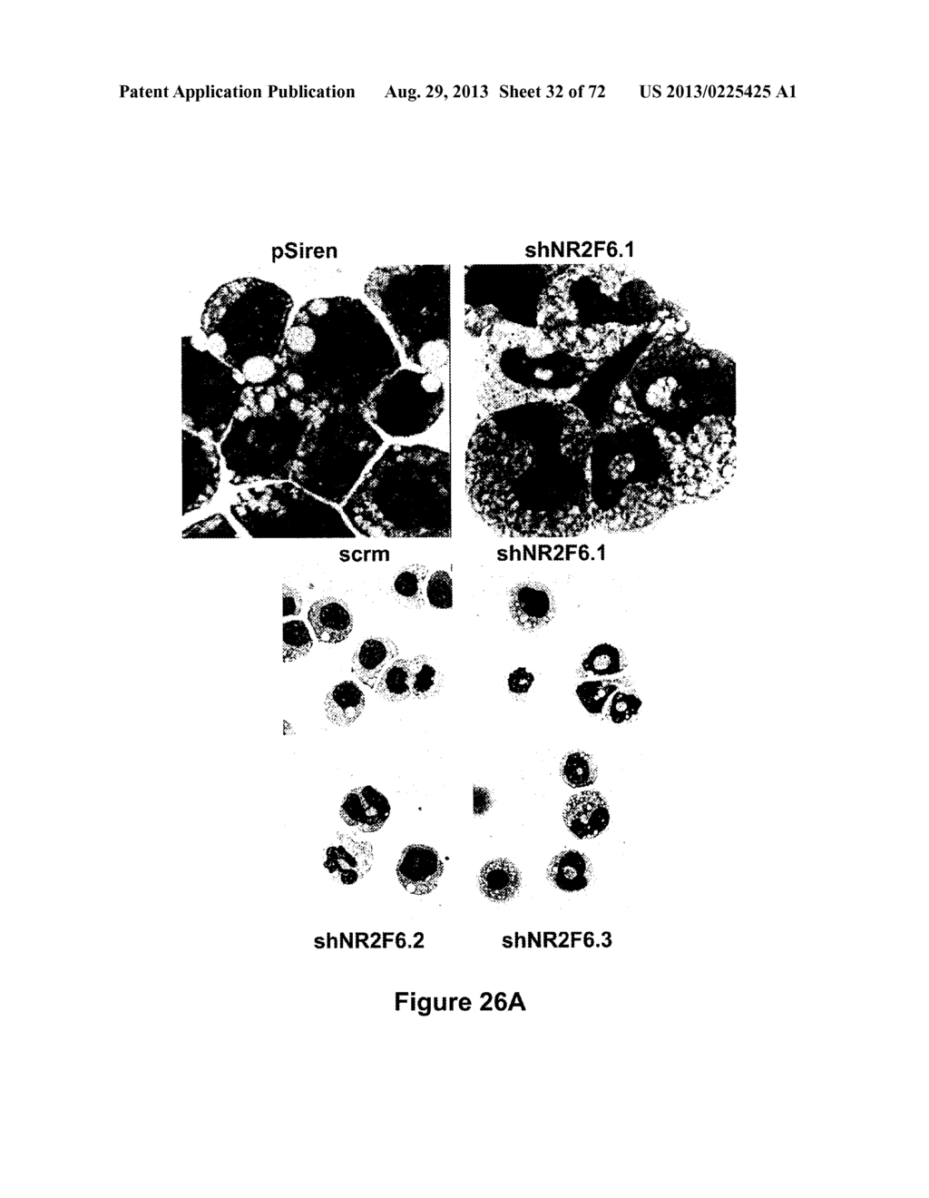 Modulation of NR2F6 and methods and uses thereof - diagram, schematic, and image 33