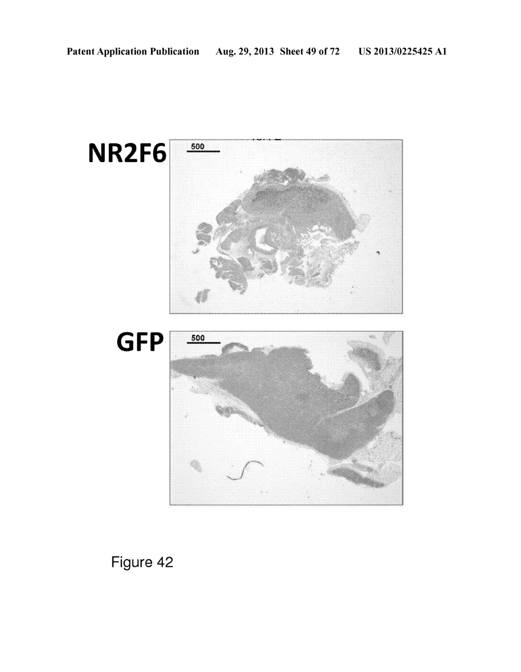 Modulation of NR2F6 and methods and uses thereof - diagram, schematic, and image 50