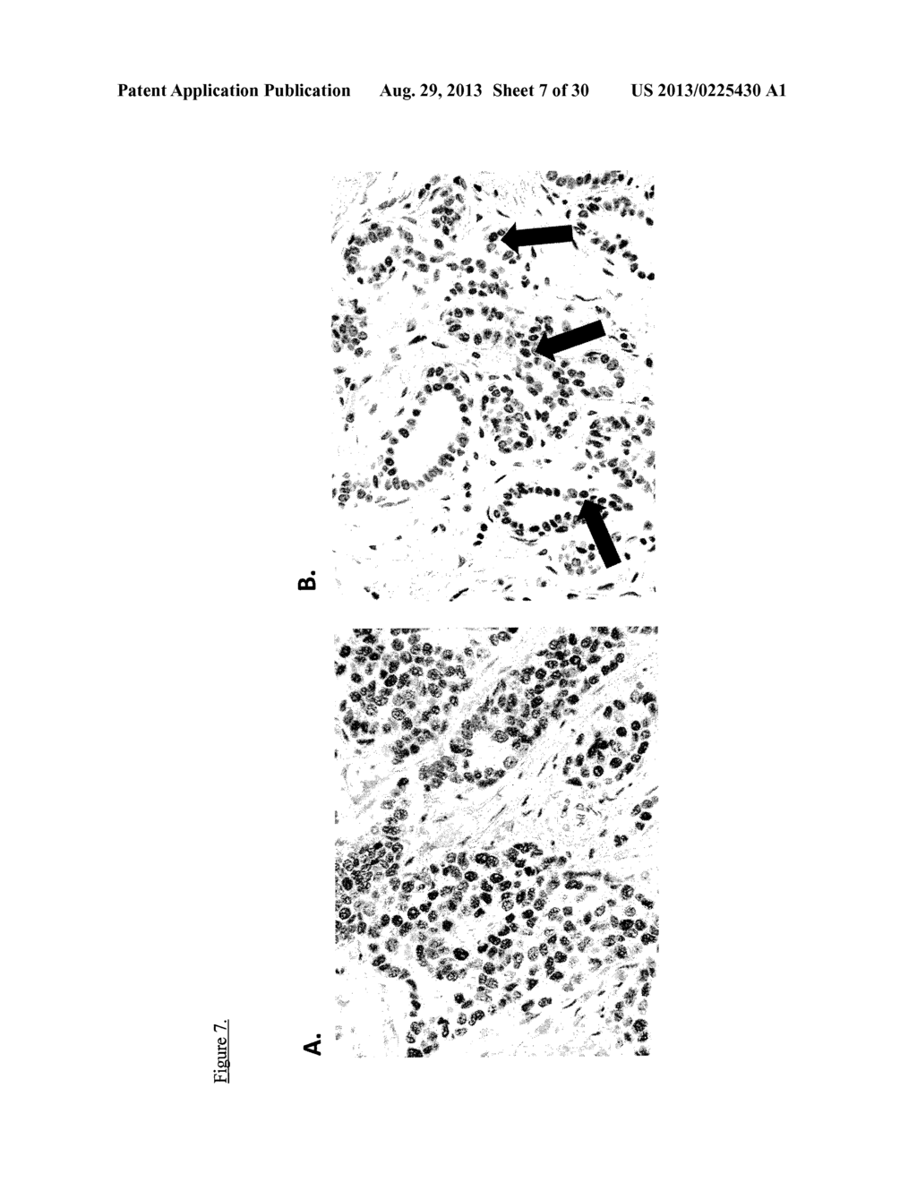 METHODS AND COMPOSITIONS FOR TREATMENT OF TOX-3 AND TFF-1 MEDIATED CANCER     PATHOGENESIS - diagram, schematic, and image 08