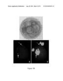 ASSESSMENT OF CELLULAR FRAGMENTATION DYNAMICS FOR DETECTION OF HUMAN     EMBRYONIC ANEUPLOIDY diagram and image