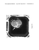 ASSESSMENT OF CELLULAR FRAGMENTATION DYNAMICS FOR DETECTION OF HUMAN     EMBRYONIC ANEUPLOIDY diagram and image