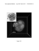 ASSESSMENT OF CELLULAR FRAGMENTATION DYNAMICS FOR DETECTION OF HUMAN     EMBRYONIC ANEUPLOIDY diagram and image