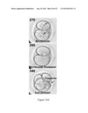 ASSESSMENT OF CELLULAR FRAGMENTATION DYNAMICS FOR DETECTION OF HUMAN     EMBRYONIC ANEUPLOIDY diagram and image