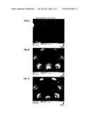 QUATERNIZED POLYETHER AMINES AND THEIR USE AS ADDITIVE FOR FUELS AND     LUBRICANTS diagram and image