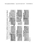 Combinations of TGFBeta and COX-2 Inhibitors and Methods for Their     Therapeutic Application diagram and image