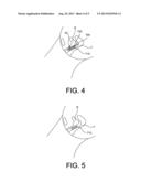 MATERIALS AND METHODS FOR SECURING BODILY IMPLANTS diagram and image