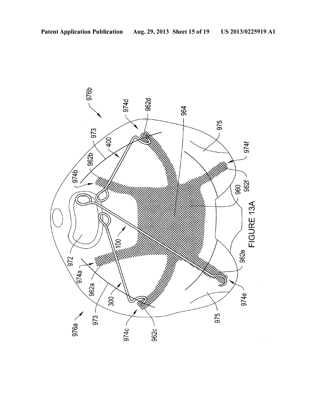 SYSTEMS, DEVICES AND METHODS FOR TREATING PELVIC FLOOR DISORDERS - diagram, schematic, and image 16