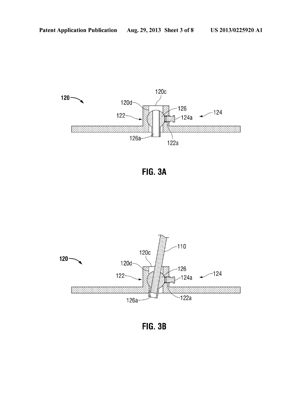 SURGICAL SUPPORT ASSEMBLY - diagram, schematic, and image 04