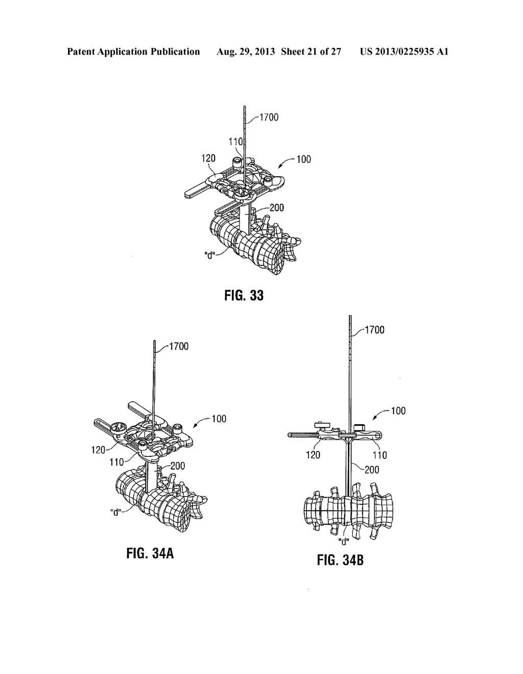 LATERAL ACCESS SYSTEM AND METHOD OF USE - diagram, schematic, and image 22