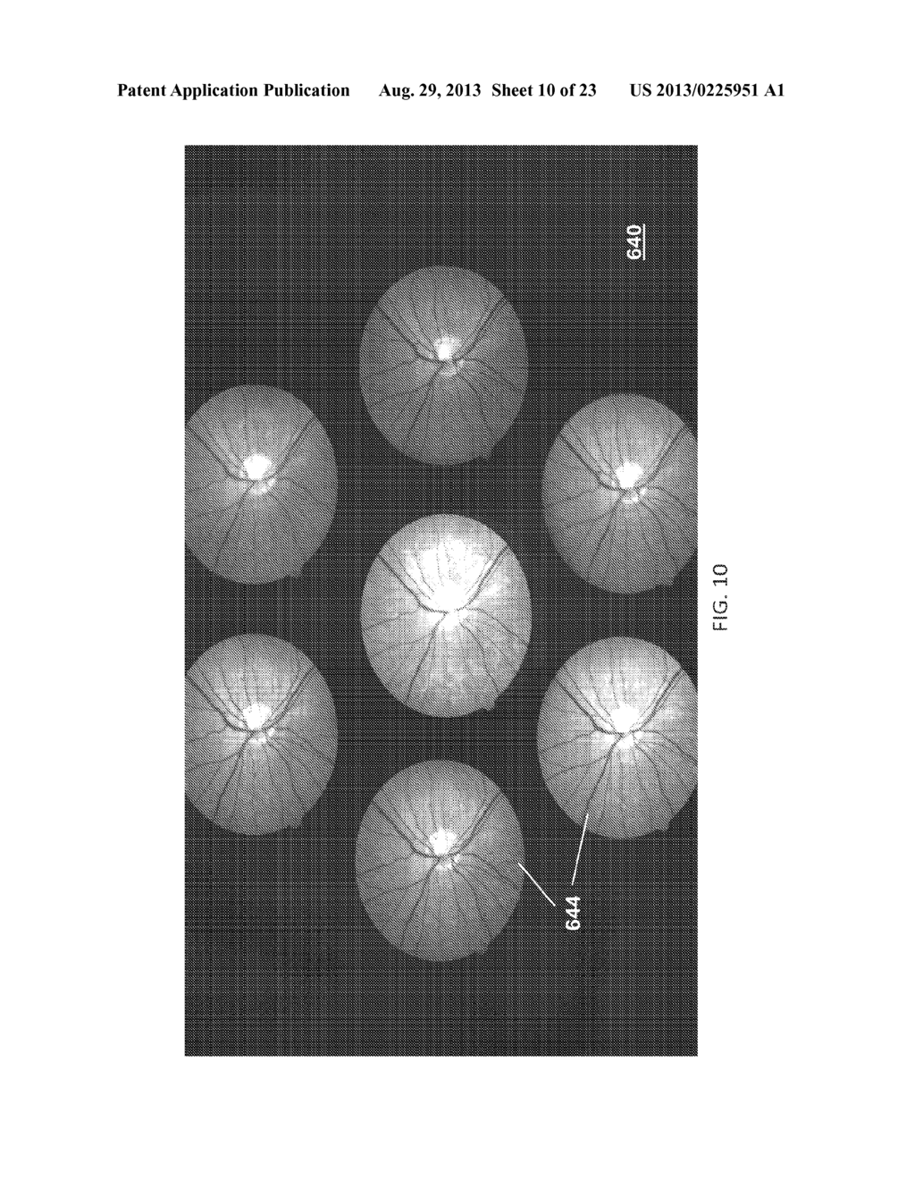 DETERMINATION OF OXYGEN SATURATION IN A TISSUE OF VISUAL SYSTEM - diagram, schematic, and image 11