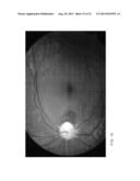 DETERMINATION OF OXYGEN SATURATION IN A TISSUE OF VISUAL SYSTEM diagram and image