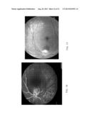 DETERMINATION OF OXYGEN SATURATION IN A TISSUE OF VISUAL SYSTEM diagram and image