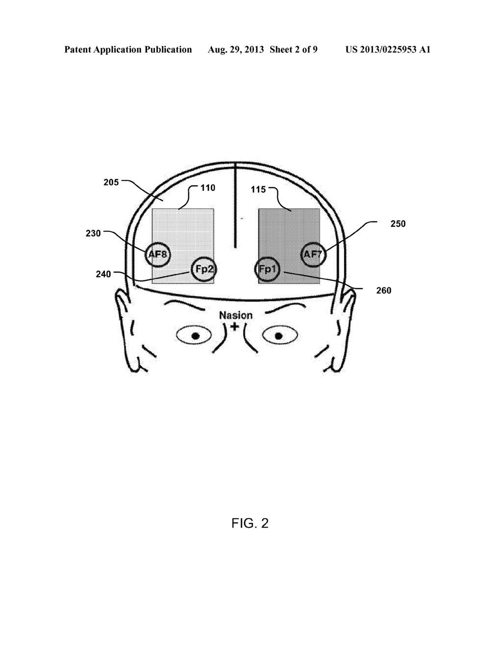 CONCURRENT STIMULATION EFFECT DETECTION - diagram, schematic, and image 03