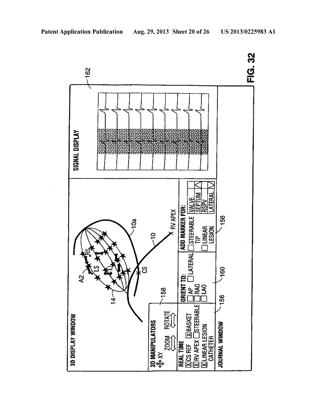 SYSTEM AND METHOD FOR MARKING AN ANATOMICAL STRUCTURE IN THREE-DIMENSIONAL     COORDINATE SYSTEM - diagram, schematic, and image 21