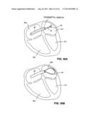 SYSTEM AND METHOD FOR MARKING AN ANATOMICAL STRUCTURE IN THREE-DIMENSIONAL     COORDINATE SYSTEM diagram and image