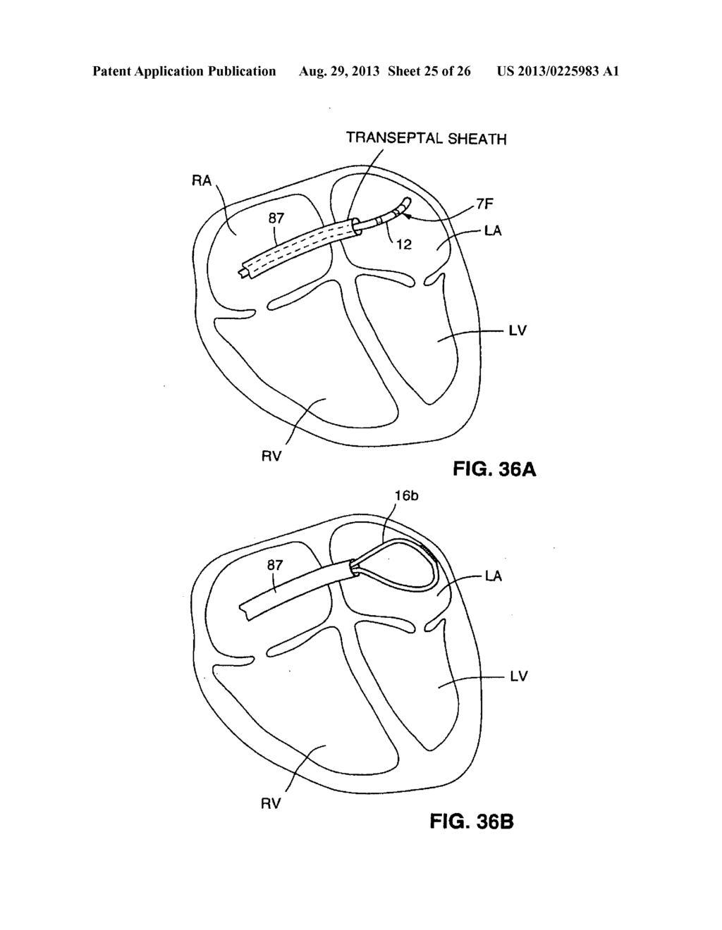 SYSTEM AND METHOD FOR MARKING AN ANATOMICAL STRUCTURE IN THREE-DIMENSIONAL     COORDINATE SYSTEM - diagram, schematic, and image 26