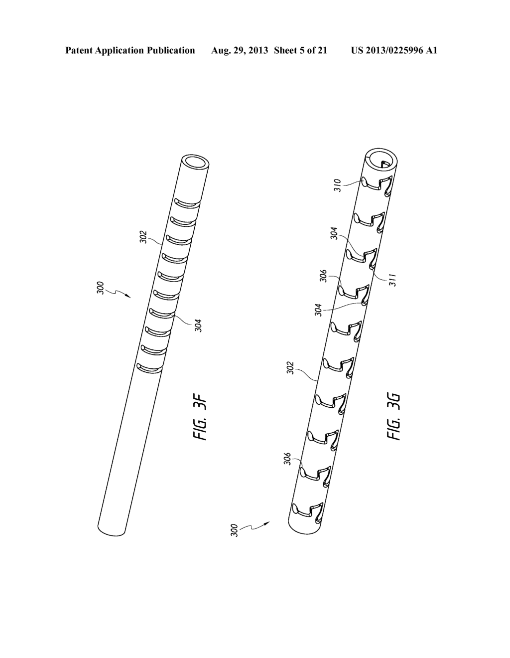 LUNG BIOPSY NEEDLE - diagram, schematic, and image 06