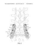 System for Determining the Quality of an Individual s Bone Structure diagram and image