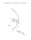 DEVICES AND METHODS FOR PERFORMING PROCEDURES ON A BREAST diagram and image