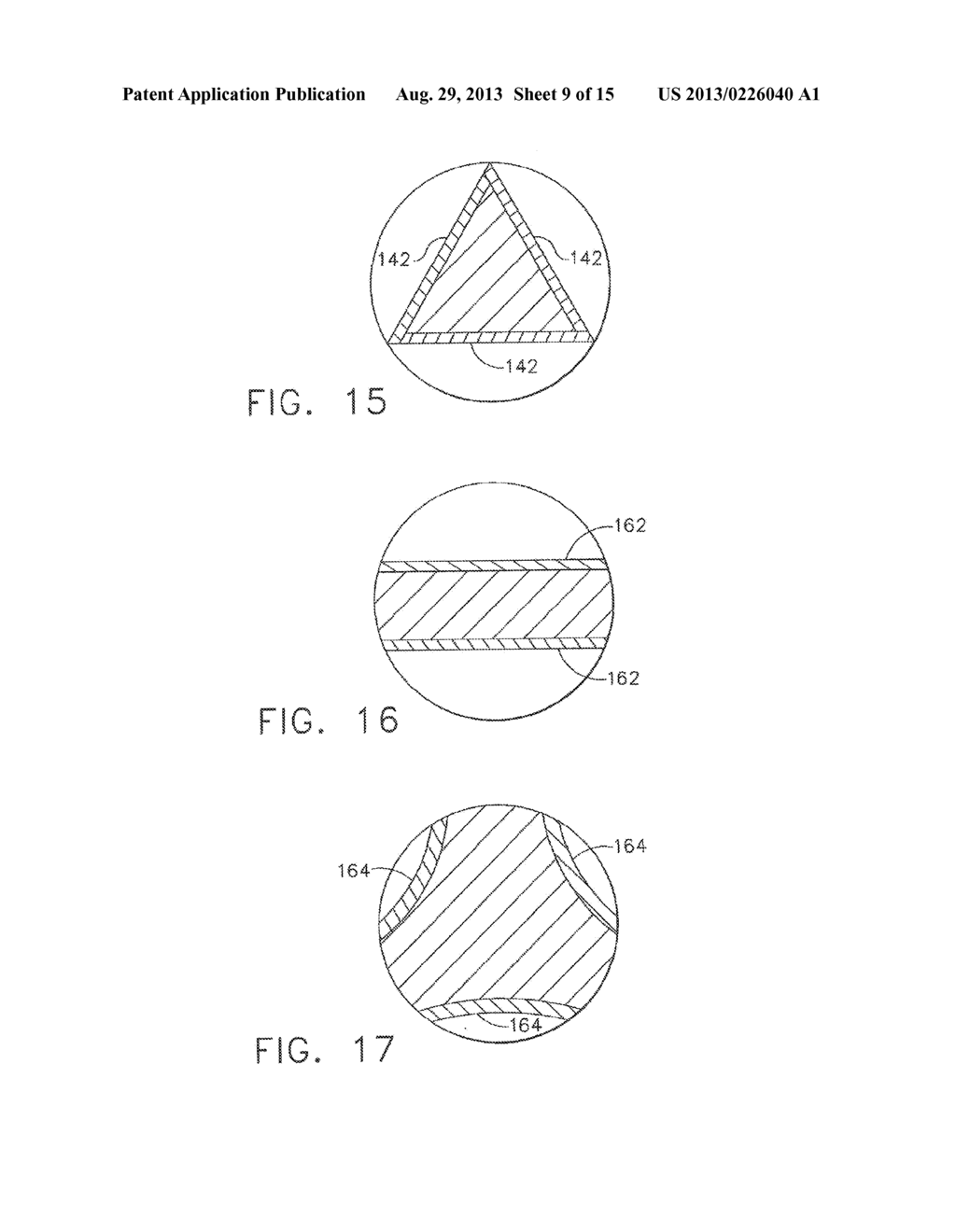 Tissue-Retaining Systems for Ultrasound Medical Treatment - diagram, schematic, and image 10