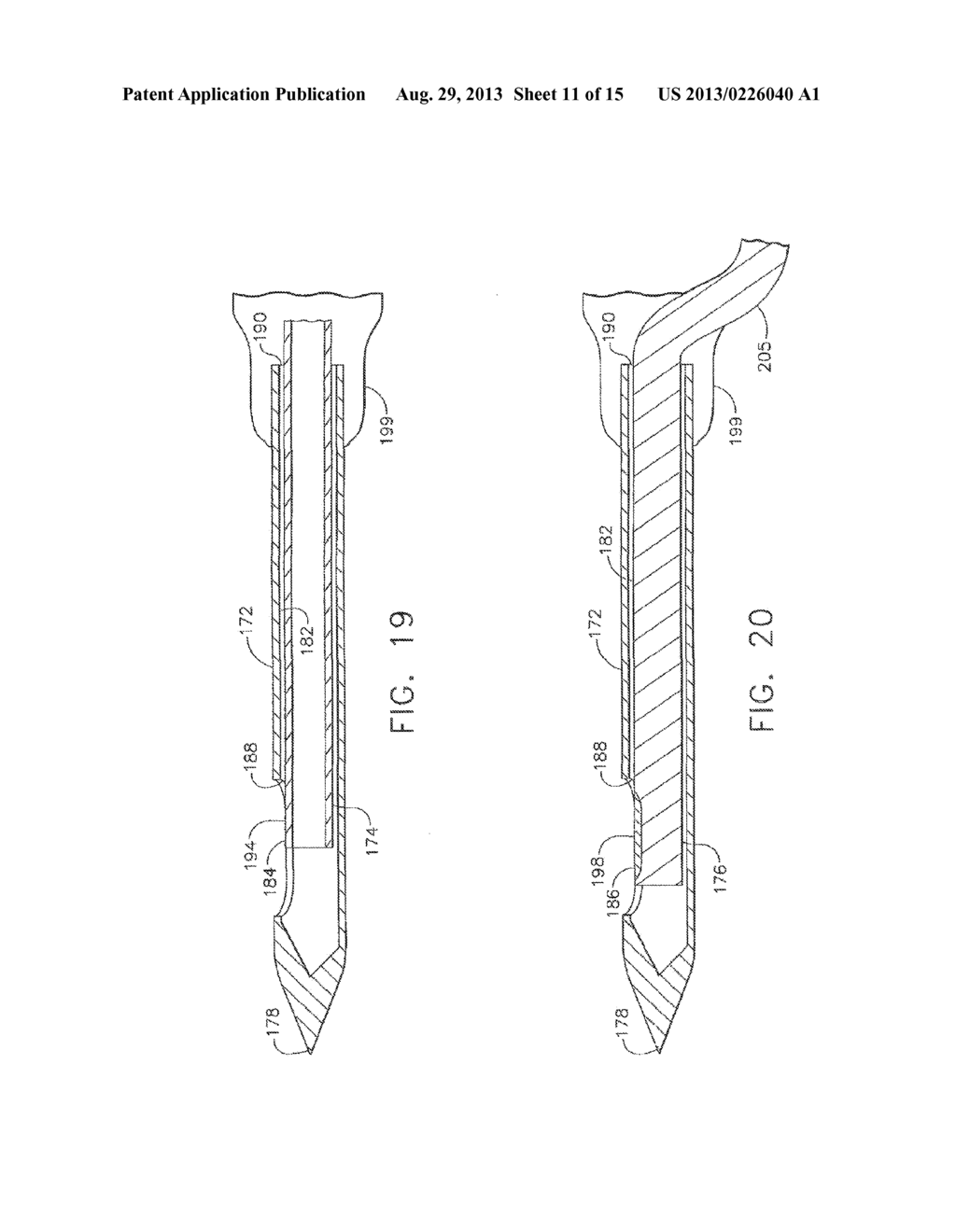 Tissue-Retaining Systems for Ultrasound Medical Treatment - diagram, schematic, and image 12