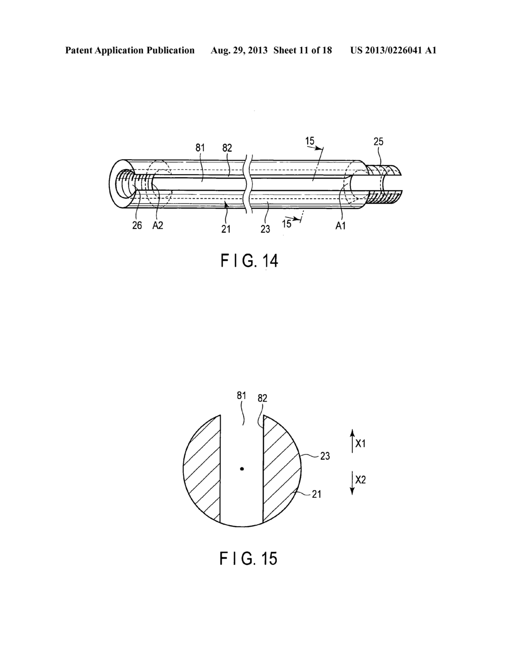 ULTRASONIC TREATMENT DEVICE AND PROBE UNIT - diagram, schematic, and image 12