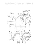 Brace diagram and image