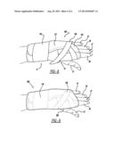 Brace diagram and image