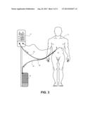 Hypothermia Devices and Methods diagram and image