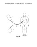 Hypothermia Devices and Methods diagram and image