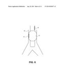 Hypothermia Devices and Methods diagram and image