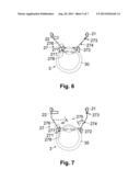 APPARATUS FOR TREATING EYE TISSUE WITH LASER PULSES diagram and image