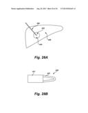 MULTI-MODE SURGICAL TOOL diagram and image